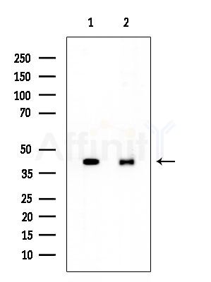 Phospho-PKA beta (Thr197)[Thr198] Antibody - Western blot analysis of lysates from various samples, using Phospho-PKA beta (Thr197)[Thr198] Antibody at 1/1000 dilution.