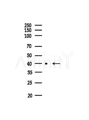 Phospho-PKA beta (Thr197)[Thr198] Antibody - Western blot analysis of lysates from EC304 cells, using Phospho-PKA beta (Thr197)[Thr198] Antibody at 1/1000 dilution.