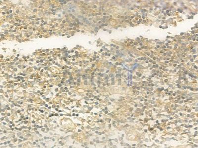 Phospho-PKA beta (Thr197)[Thr198] Antibody - DF7589 at 1/100 staining human normal tonsil tissue by IHC-P.