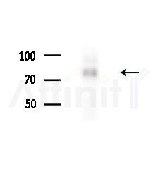 CLCN3 Antibody - Western blot analysis of extracts from 293 cells(UV treatment), using CLCN3 Antibody at 1/1000 dilution.
