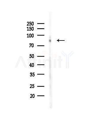 CLCN3 Antibody - Western blot analysis of lysates from 293 cells(UV treatment), using CLCN3 Antibody at 1/1000 dilution.