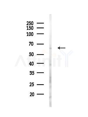 USP22 Antibody - Western blot analysis of lysates from Hela cells(LPS,4h treatment), using USP22 Antibody at 1/1000 dilution.