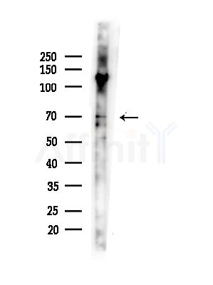 Elastin Antibody - Western blot analysis of lysates from COLO205 cells(heat-shock,45min treatment), using Elastin Antibody at 1/1000 dilution.
