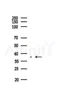 NCR1 Antibody - Western blot analysis of lysates from PC12 cells(LPS,4h treatment), using NCR1 Antibody at 1/1000 dilution.