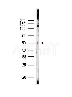 Perilipin-1 Antibody - Western blot analysis of lysates from Rat testis, using Perilipin-1 Antibody at 1/1000 dilution.