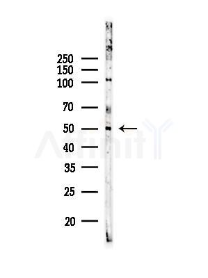 Perilipin-1 Antibody - Western blot analysis of lysates from EC304 cells, using Perilipin-1 Antibody at 1/1000 dilution.