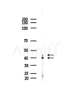 Caspase 4/11 Antibody - Western blot analysis of lysates from A375 cells(heat-shock,45min treatment), using Caspase 4/11 Antibody at 1/1000 dilution.