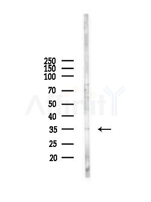 TMX2 Antibody - Western blot analysis of lysates from A375 cells(starvation,24h treatment), using TMX2 Antibody at 1/1000 dilution.