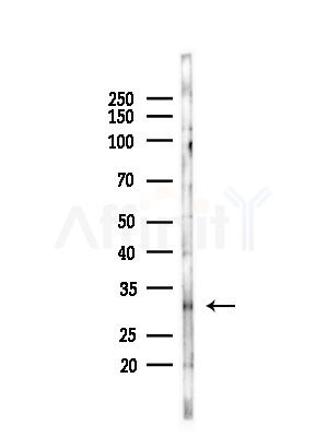 LAT Antibody - Western blot analysis of lysates from LoVo cells(heat-shock,45min treatment), using LAT Antibody at 1/1000 dilution.
