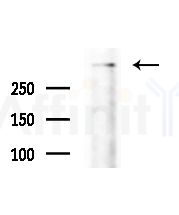 PLEC Antibody - Western blot analysis of extracts from Rat brain, using PLEC Antibody at 1/1000 dilution.