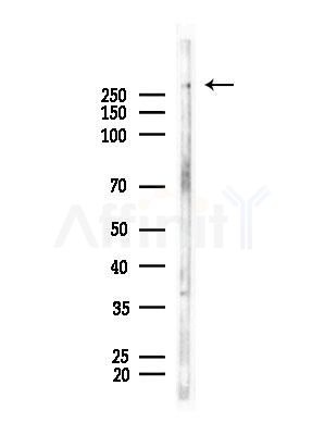 PLEC Antibody - Western blot analysis of lysates from Rat brain, using PLEC Antibody at 1/1000 dilution.