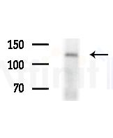 C11orf30 Antibody - Western blot analysis of extracts from various samples, using C11orf30 Antibody at 1/1000 dilution.