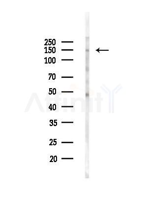 C11orf30 Antibody - Western blot analysis of lysates from Hela cells(LPS,4h treatment), using C11orf30 Antibody at 1/1000 dilution.