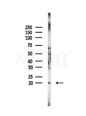 MYCB Antibody - Western blot analysis of lysates from Mouse testis, using MYCB Antibody at 1/1000 dilution.