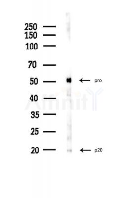 Caspase 5 Antibody - Western blot analysis of lysates from LoVo cells(heat-shock,45min treatment), using Caspase 5 Antibody at 1/1000 dilution.