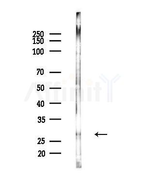 Flt3 ligand Antibody - Western blot analysis of lysates from B16F10-LUC cells(UV,30min treatment), using Flt3 ligand Antibody at 1/1000 dilution.
