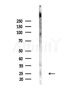 Flt3 ligand Antibody - Western blot analysis of lysates from MCF7 cells(heat-shock,45min treatment), using Flt3 ligand Antibody at 1/1000 dilution.