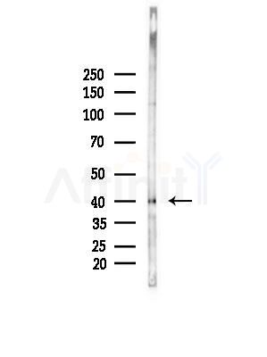 IHH Antibody - Western blot analysis of lysates from HepG2 cells(LPS, 4h treatment), using IHH Antibody at 1/1000 dilution.