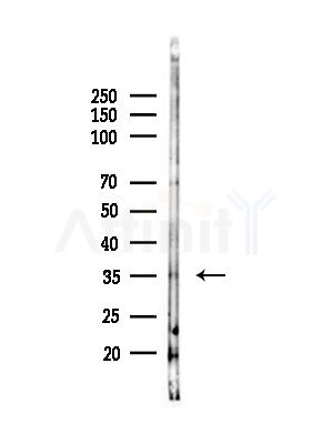 TGIF1 Antibody - Western blot analysis of lysates from COLO205 cells(UV,30min treatment), using TGIF1 Antibody at 1/1000 dilution.