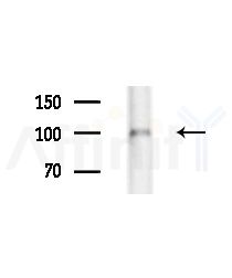 IPO9 Antibody - Western blot analysis of extracts from Hela cells(heat-shock,45min treatment), using IPO9 Antibody at 1/1000 dilution.