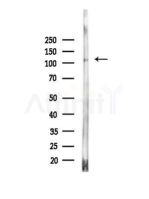 IPO9 Antibody - Western blot analysis of lysates from Hela cells(heat-shock,45min treatment), using IPO9 Antibody at 1/1000 dilution.
