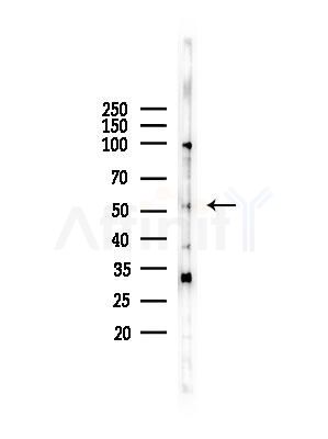 MST1/STK4 Antibody - Western blot analysis of lysates from Hela cells(heat-shock,45min treatment), using MST1/STK4 Antibody at 1/1000 dilution.