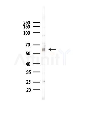 MST2/STK3 Antibody - Western blot analysis of lysates from COLO205 cells(heat-shock,45min treatment), using MST2/STK3 Antibody at 1/1000 dilution.