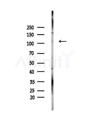 ABCG1 Antibody - Western blot analysis of lysates from Hela cells(heat-shock,45min treatment), using ABCG1 Antibody at 1/1000 dilution.