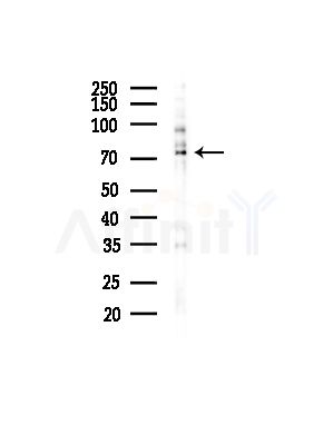 MMP21 Antibody - Western blot analysis of lysates from COLO205 cells(UV,30min treatment), using MMP21 Antibody at 1/1000 dilution.