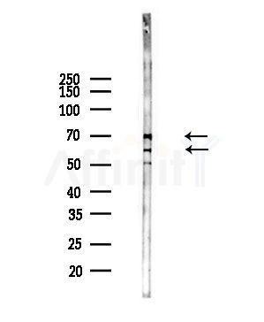 FATP1 Antibody - Western blot analysis of lysates from Hela cells(heat-shock,45min treatment), using FATP1 Antibody at 1/1000 dilution.