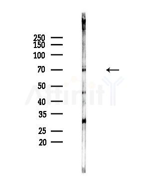 FATP1 Antibody - Western blot analysis of lysates from PC12 cells(starvation,24h treatment), using FATP1 Antibody at 1/1000 dilution.