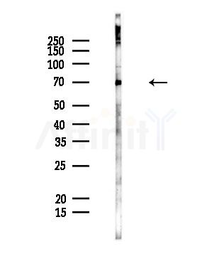 FATP1 Antibody - Western blot analysis of lysates from Rat liver, using FATP1 Antibody at 1/1000 dilution.