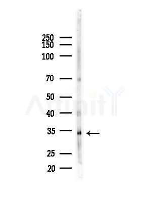 UCP1 Antibody - Western blot analysis of lysates from B16F10-LUC cells(starvation,24h treatment), using UCP1 Antibody at 1/1000 dilution.
