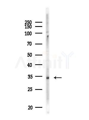UCP1 Antibody - Western blot analysis of lysates from MDA-MB-231 cells(heat-shock,45min treatment), using UCP1 Antibody at 1/1000 dilution.