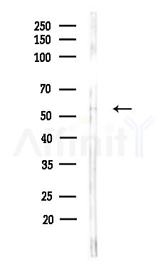 IRG1 Antibody - Western blot analysis of lysates from Hela cells(heat-shock,45min treatment), using IRG1 Antibody at 1/1000 dilution.