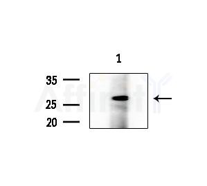 GDNF Antibody - Western blot analysis of extracts from Mouse lung, using GDNF Antibody at 1/1000 dilution.