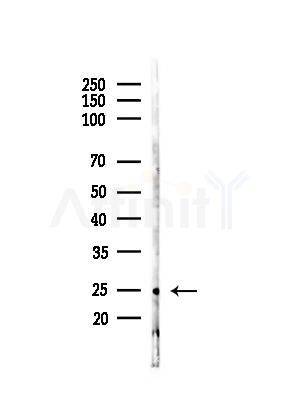 GDNF Antibody - Western blot analysis of lysates from Mouse lung, using GDNF Antibody at 1/1000 dilution.