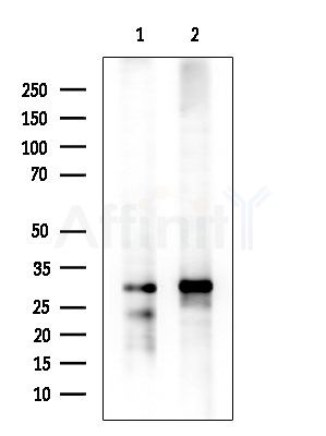 Pan Methylated Lysine Antibody - Western blot analysis of extracts from various samples, using Pan Methylated Lysine Antibody at 1/1000 dilution.