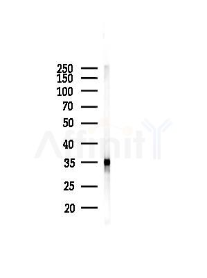 Pan Methylated Lysine Antibody - Western blot analysis of lysates from HUVEC cells, using Pan Methylated Lysine Antibody at 1/1000 dilution.