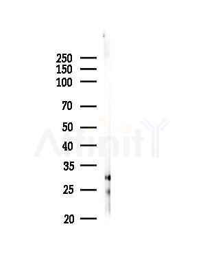 Pan Methylated Lysine Antibody - Western blot analysis of lysates from EC304 cells, using Pan Methylated Lysine Antibody at 1/1000 dilution.