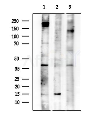 Acetyl-Lysine Antibody - Western blot analysis of extracts from various samples, using Acetyl-Lysine Antibody at 1/1000 dilution.