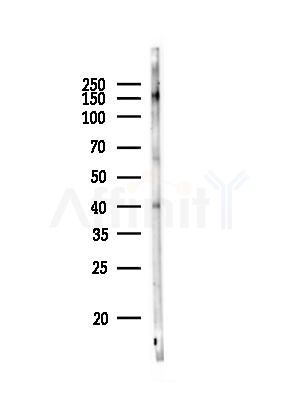 Acetyl-Lysine Antibody - Western blot analysis of lysates from Rat testis, using Acetyl-Lysine Antibody at 1/1000 dilution.