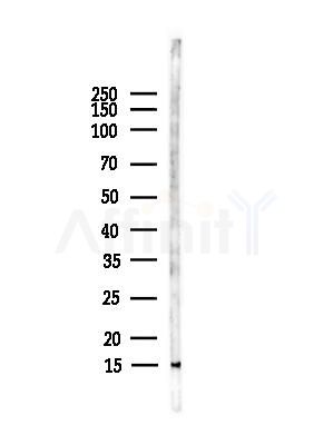 Acetyl-Lysine Antibody - Western blot analysis of lysates from HUVEC cells, using Acetyl-Lysine Antibody at 1/1000 dilution.