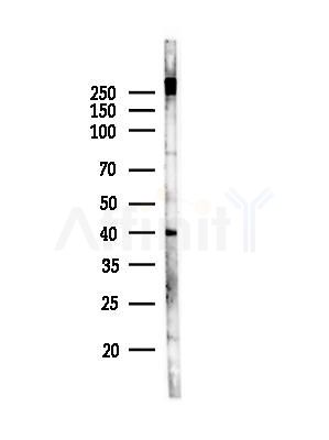 Acetyl-Lysine Antibody - Western blot analysis of lysates from EC304 cells, using Acetyl-Lysine Antibody at 1/1000 dilution.