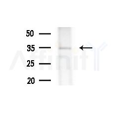 osterix Antibody - Western blot analysis of extracts from HepG2 cells(LPS,4h treatment), using osterix Antibody at 1/1000 dilution.
