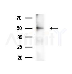 osterix Antibody - Western blot analysis of extracts from Rat brain, using osterix Antibody at 1/1000 dilution.