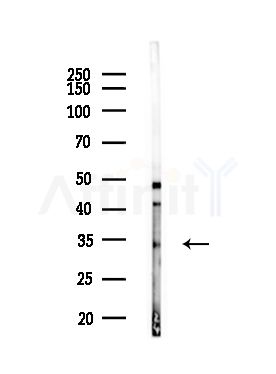 SPEE Antibody - Western blot analysis of lysates from MDA-MB-231 cells(heat-shock,45min treatment), using SPEE Antibody at 1/1000 dilution.