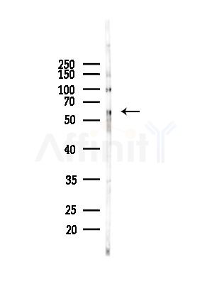 UGT2B Antibody - Western blot analysis of lysates from COLO205 cells(heat-shock,45min treatment), using UGT2B Antibody at 1/1000 dilution.