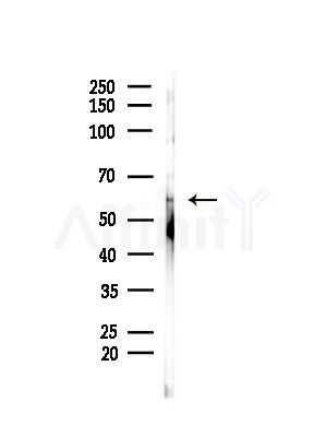 UGT2B Antibody - Western blot analysis of lysates from MDA-MB-231 cells(heat-shock,45min treatment), using UGT2B Antibody at 1/1000 dilution.