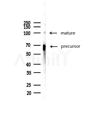 CD166 Antibody - Western blot analysis of lysates from COLO205 cells(heat-shock,45min treatment), using CD166 Antibody at 1/1000 dilution.